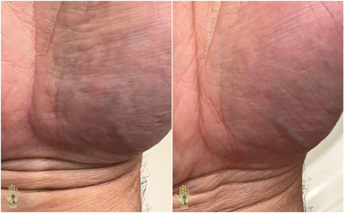 Образ женщины на холме Венеры. Оригинал и обработка фото для наглядности - в галерее.