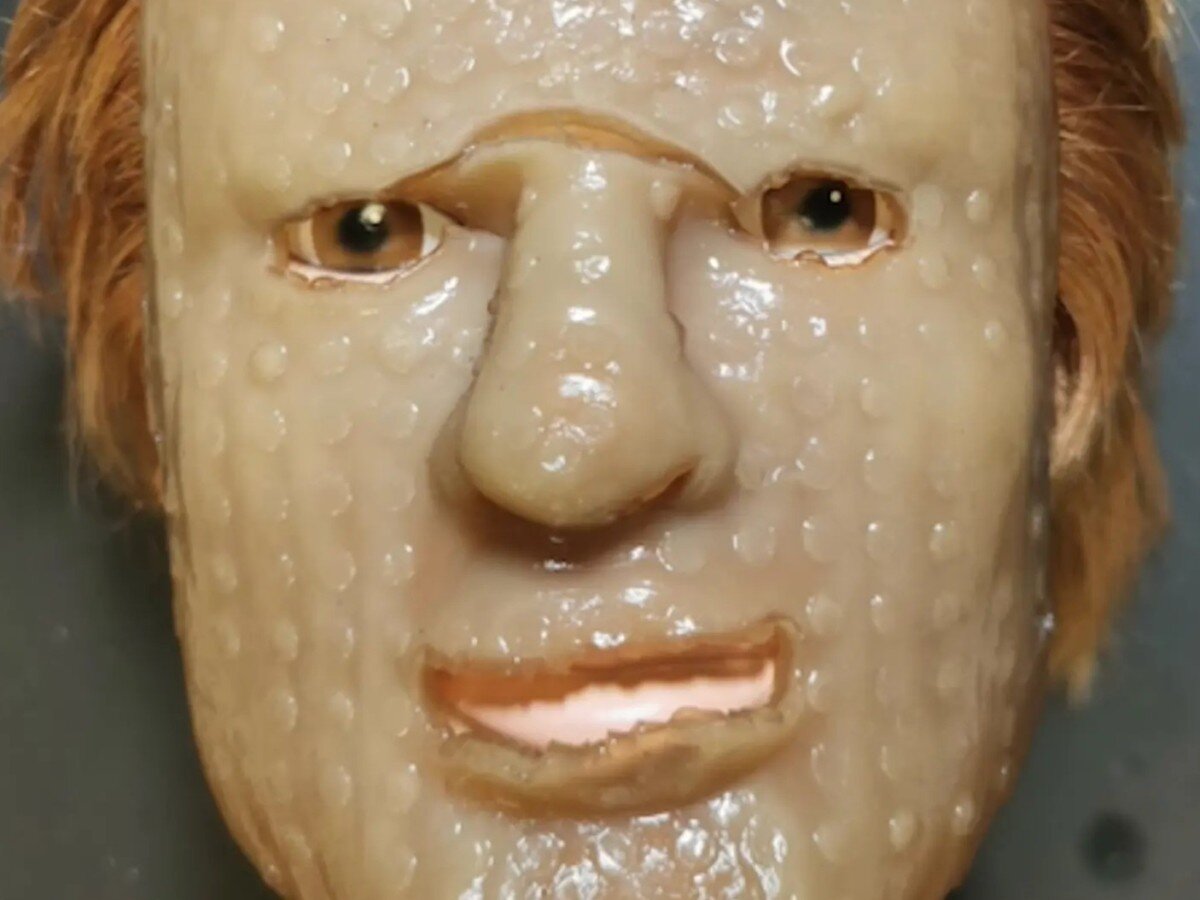    Создана повязка для ожогов, которую не больно отдирать от кожи