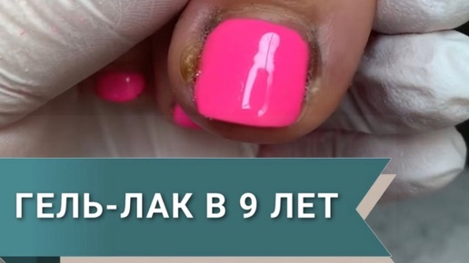 Medped.ru | В 9 лет проблемы взрослой женщины | Medped | Врос ноготь ...