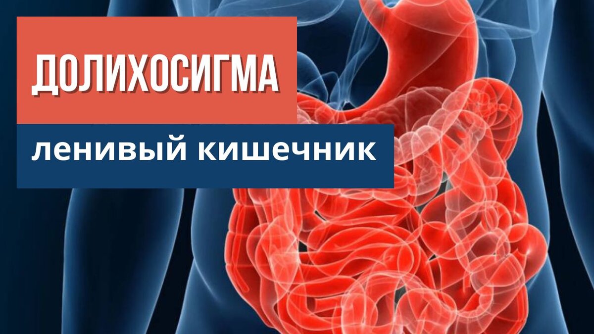 Долихосигма кишечника лечение