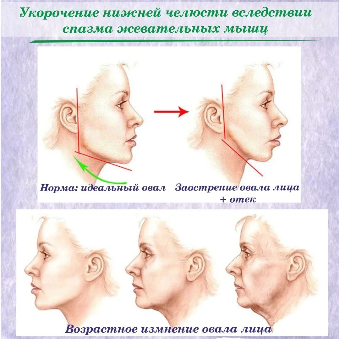 Почему сводит челюсть?