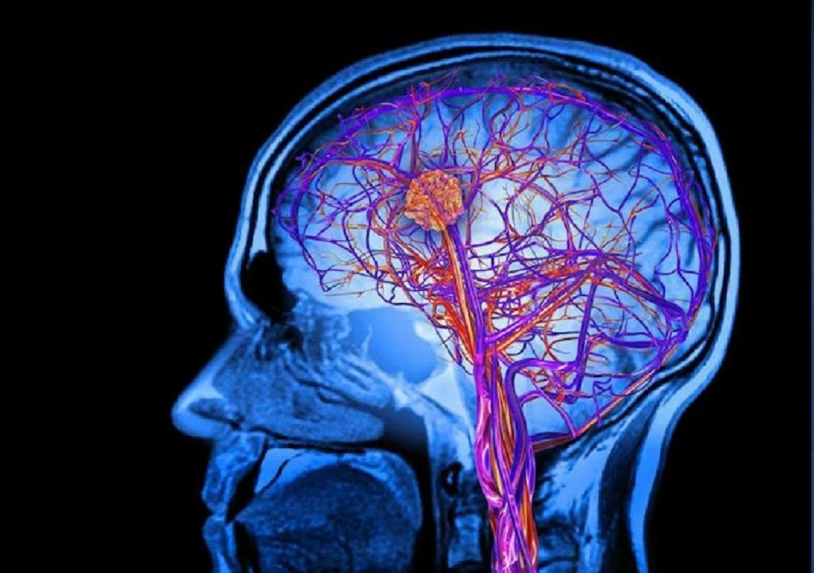 Диагноз ХИГМ: что такое ишемия головного мозга и почему она бывает опасной?  | О здоровье: с медицинского на русский | Дзен