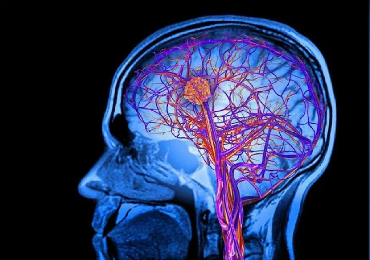 Чем опасна головного мозга. Мрт головного мозга и сосудов. Мрт артерий и вен головного мозга. Венография головного мозга. Сосудистая система мозга.