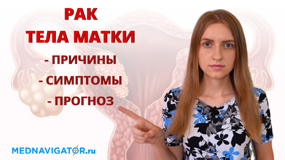 РАК ТЕЛА МАТКИ - РАК ЭНДОМЕТРИЯ - причины, признаки и симптомы, прогноз ...