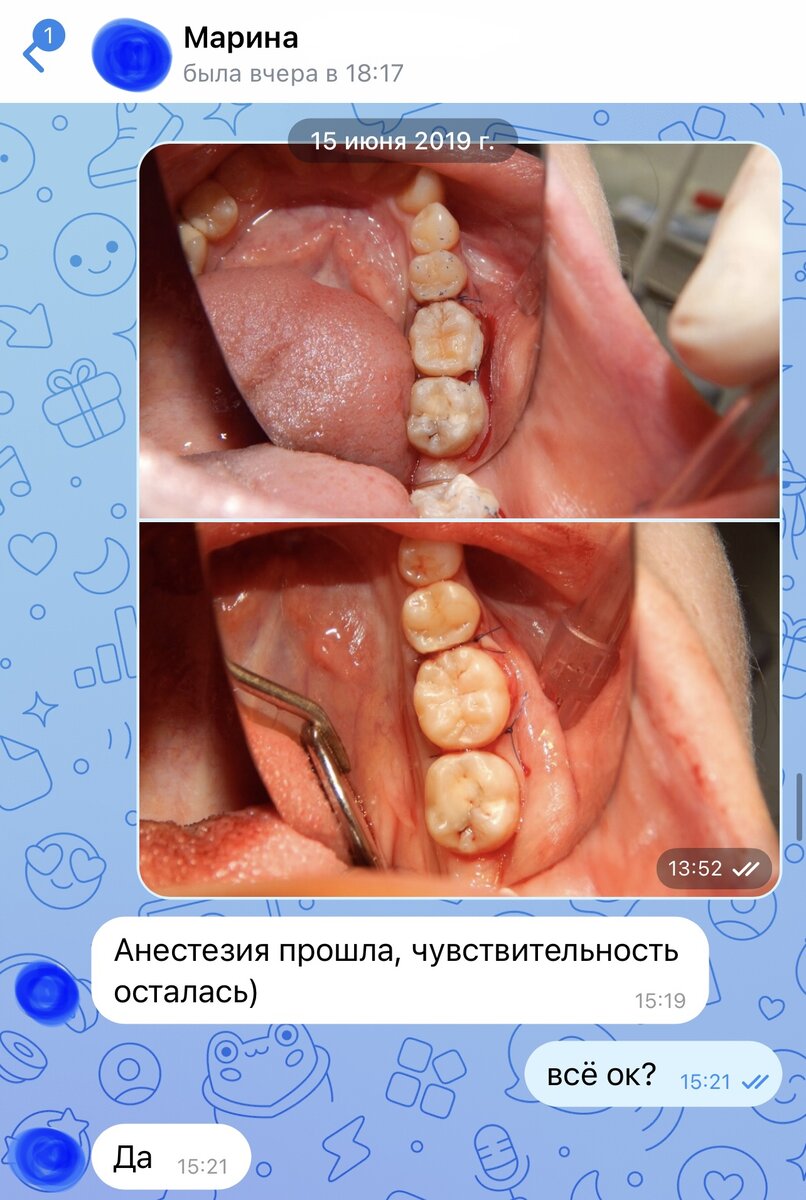 На следующий день после операции я узнал о самочувствии у пациента 