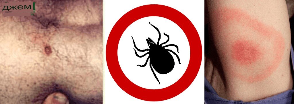 Adesea, persoanele în vârstă se plâng că le doare întregul corp și nici un remediu nu ajută, în acest material vom încerca să ne dăm seama care ar putea fi cauza și pe cine să contactăm cu ea.  De ce mă doare tot corpul?-9