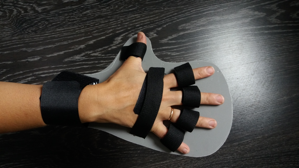 пальцы ноги после инсульта. тренажер бутон после инсульта. послеинсультный фиксатор руки. пальцы ноги после инсульта. реабилитация левой руки после инсульта.