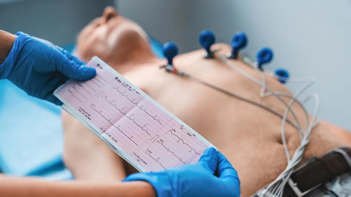 Расшифровку ЭКГ лучше доверить профессионалам