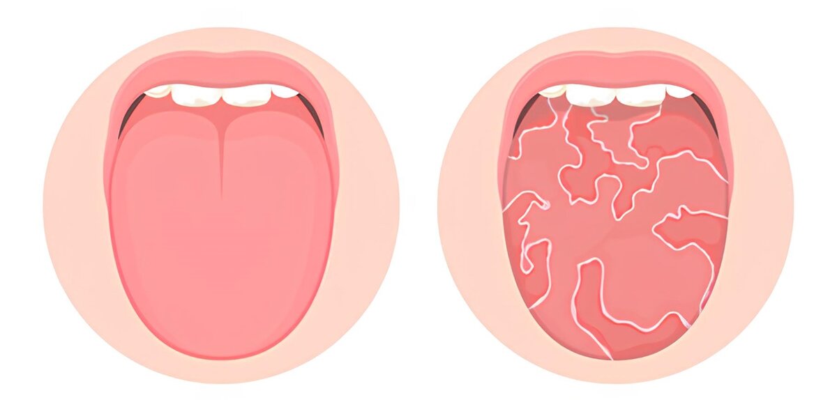 Слева- норма, справа- географический язык