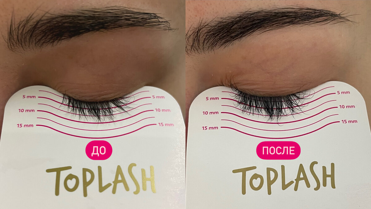 Результаты до и после через 3 недели