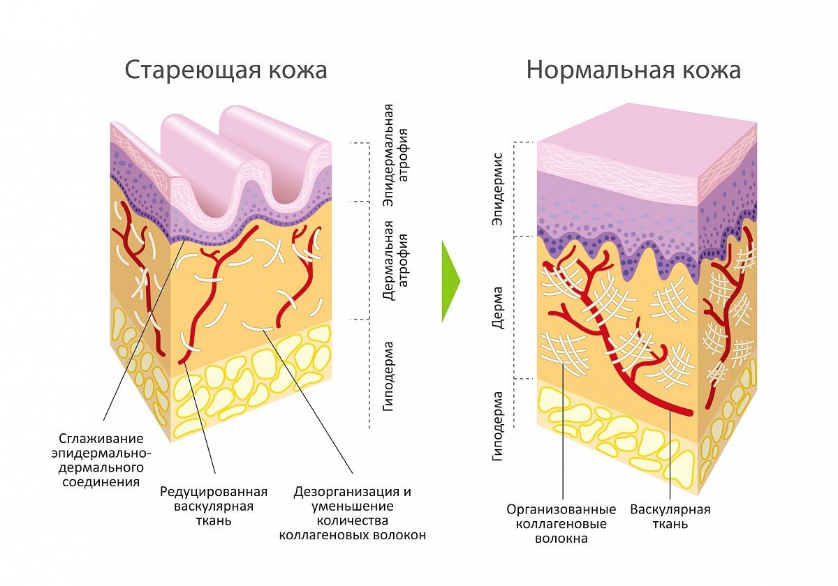 Измененный слой. Коллаген и старение кожи. Процесс старения кожи. Слои кожи лица косметология. Слои кожи в косметологии.