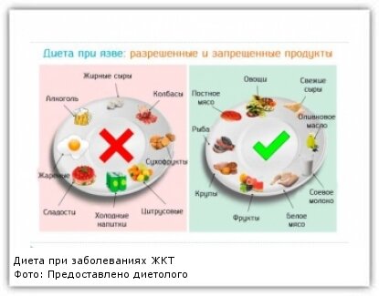 Диетологи предупреждают: опасные диеты полны «красных флажков»