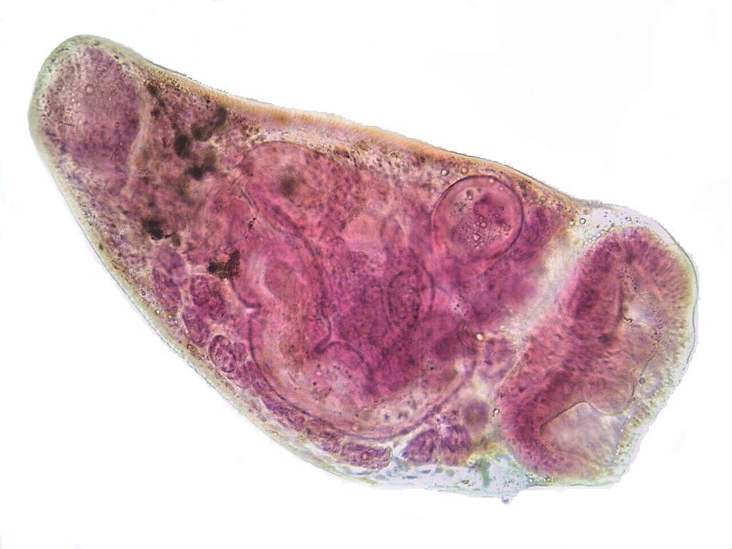 фасциола гепатика препарат. паразит печеночный сосальщик. описторхоз фасциолез. печеночный сосальщик микроскоп. яйца фасциолы.
