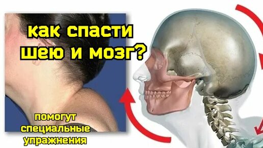 Descargar video: 2 самых вредных положения шеи. Секреты укрепления сосудов шеи и мозга