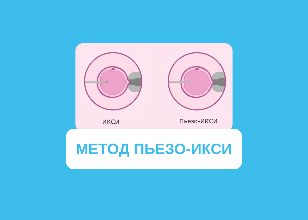 Метод Пьезо-ИКСИ