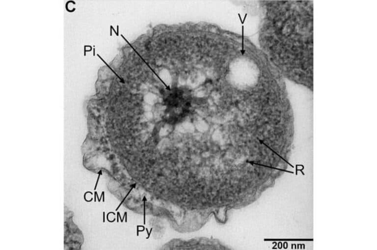    Новый вид глубоководных бактерий Poriferisphaera hetertotropicis / © Rikuan Zheng et al, eLife (2023)