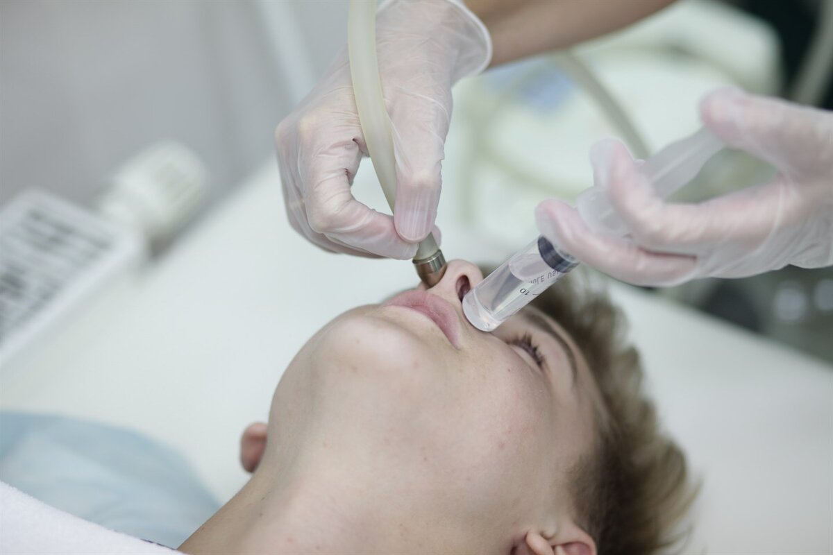 Промывание околоносовых пазух методом перемещения ("кукушка"). Источник - Яндекс. Картинки