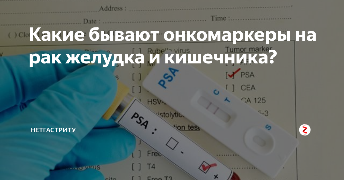Онкомаркеры на рак. Маркеры опухоли кишечника. Онкомаркер желудка и кишечника. Онкомаркеры желудок и кишечник. Онкомаркеры кишечника и прямой кишки и желудка.