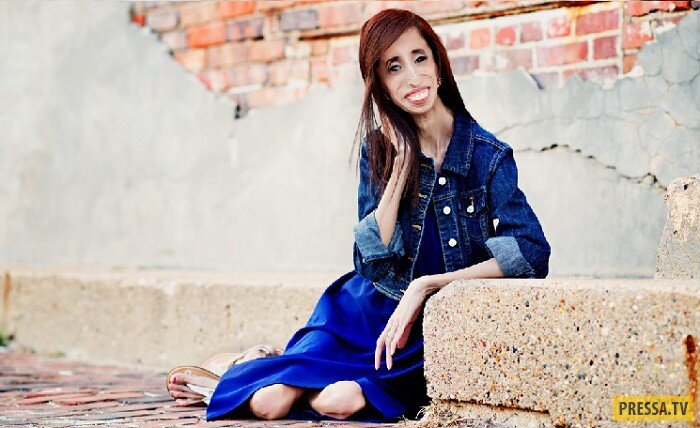 
К сожалению, не все люди на планете обладают привлекательной внешностью. Некоторые страдают от неизлечимых болезней, некоторые стали жертвами аварий или других происшествий. Но есть и те, кто сознательно уродует себя, руководствуюсь желанием быть не такими, как все. Они отдают огромные суммы, чтобы изуродовать свое тело и стать при этом самыми счастливыми. В нашем обзоре 7 необычных людей, которых занесли в рейтинг самых некрасивых людей планеты.
