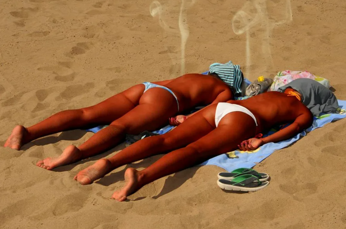 Похоже, getting sunburnt уже близко...