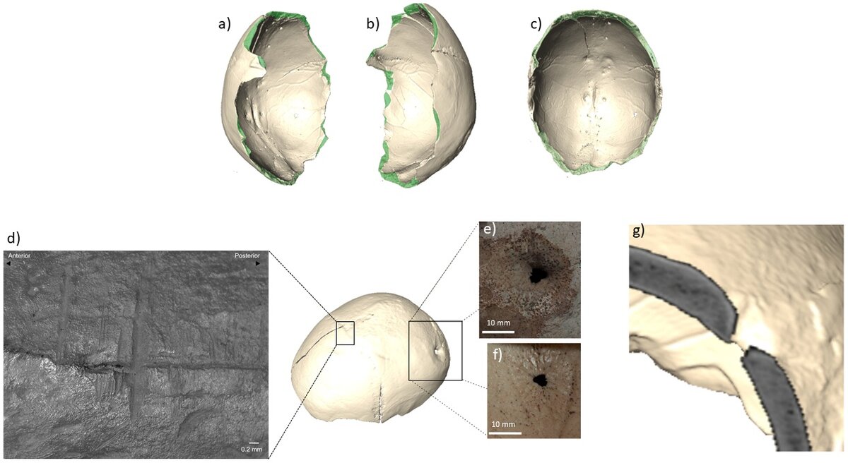 «Чаша» из черепа МА-220: вид справа (а), слева (b) и сверху (с), показаны следы ударов (зеленые участки) по краю свода черепа; (е), (g) - круглое проникающее повреждение теменной кости.