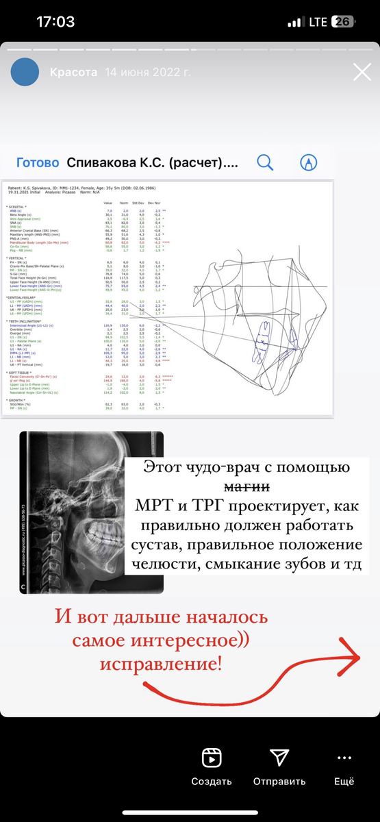Истории, в которых я рассказывала о своём лечении