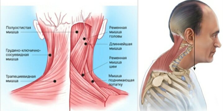 Мышцы шеи | Мышцы, Рисунки, Медицина