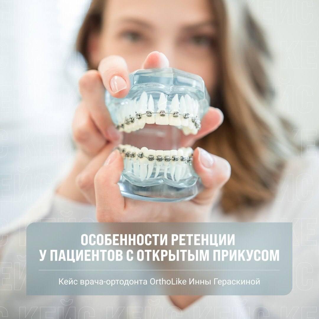 Как сохранить результат от ортодонтического лечения и закрепить зубы в  новом положении? | Андрей Жук эксперт по ортодонтии | Дзен