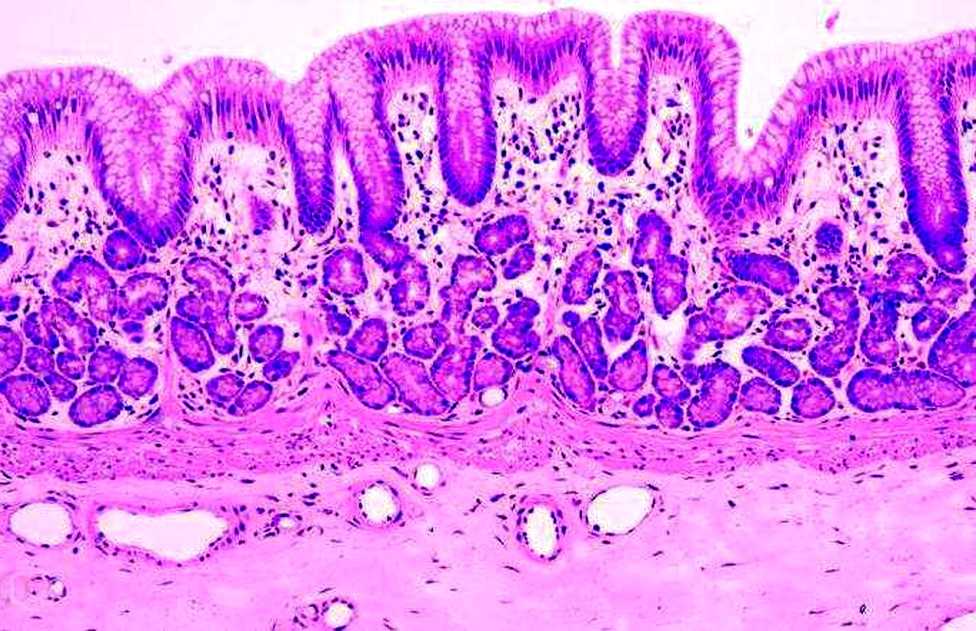 Железы желудка таблетки. Тонкая кишка гистология препарат. Железы толстой кишки гистология. Слизистая оболочка желудка гистология. Эпителий желудка гистология.