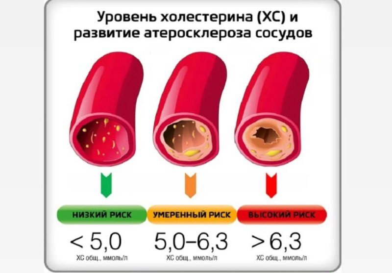 Показатели уровня холестерина. Холестерин норма у мужчин после 60 норма таблица по возрасту таблица. Норма холестерин 8. Холестерин норма у мужчин после 60 норма таблица по возрасту таблица. Показатели уровня холестерина.