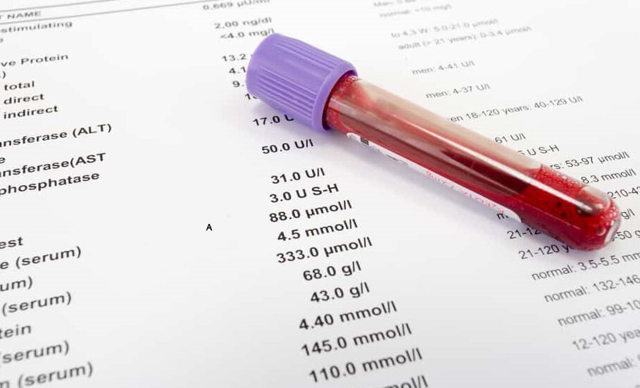 В первую очередь - это показатели почек, так как именно по ним можно определить, на сколько хорошо или плохо усваивается белок в организме