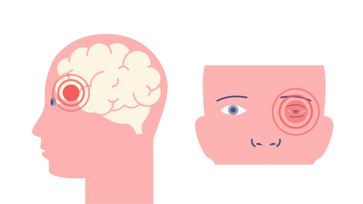 причины невралгии лицевого нерва. приступообразные боли в одной половине лица. невралгия тройничного лицевого нерва симптомы. неврит. невриты и невралгии.