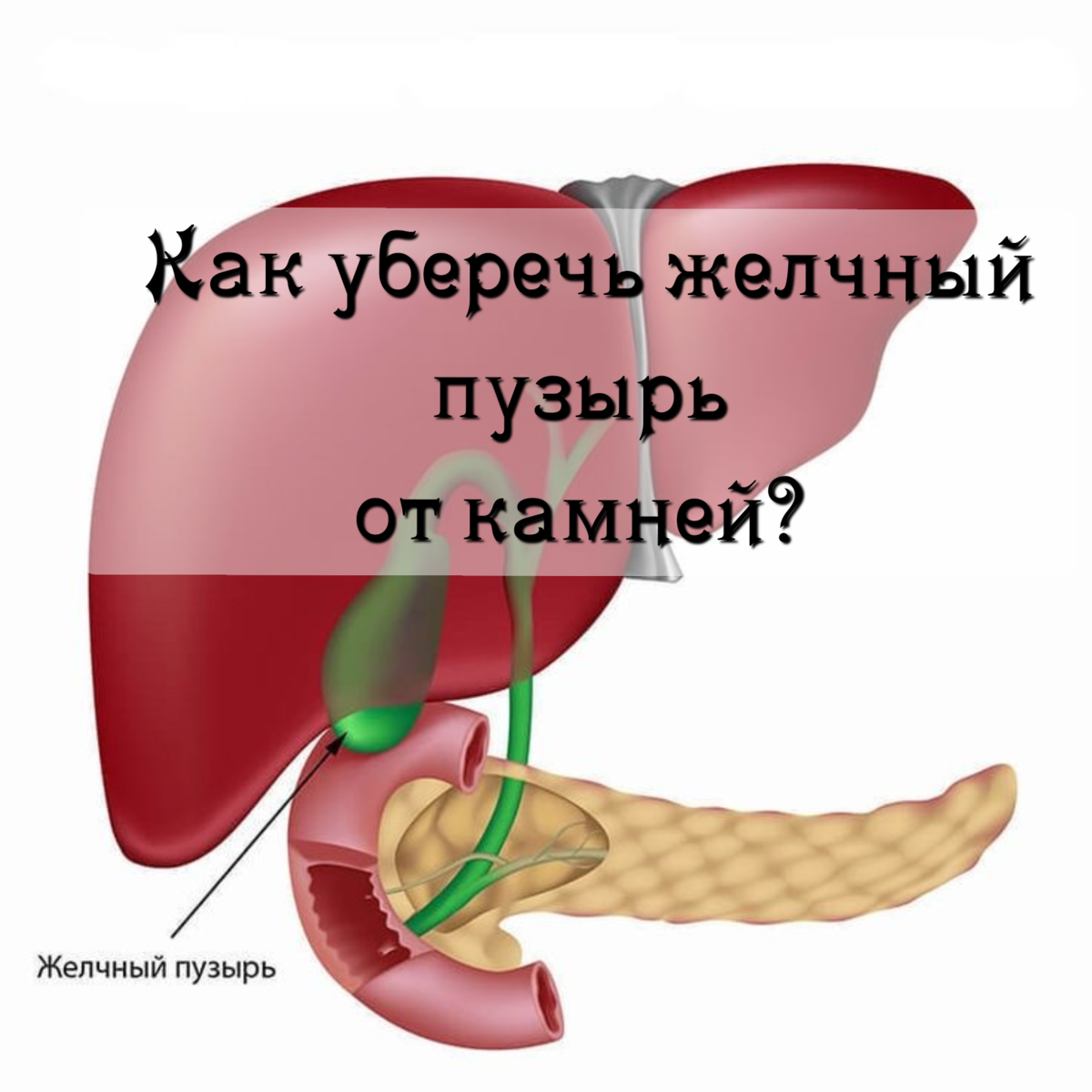 Профилактика желчнокаменной болезни | Просто о сложном (советы хирурга,  травматолога-ортопеда) | Дзен