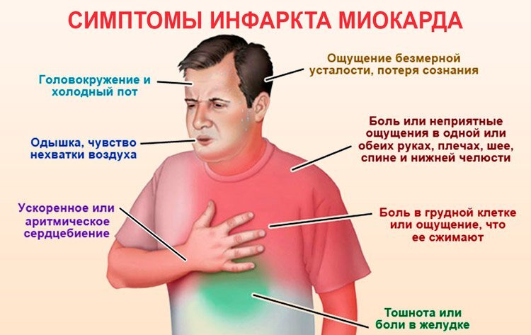 Инфаркт: Причины, симптомы, диагностика и лечение — Сеть МЦ «Доктор Боголюбов»