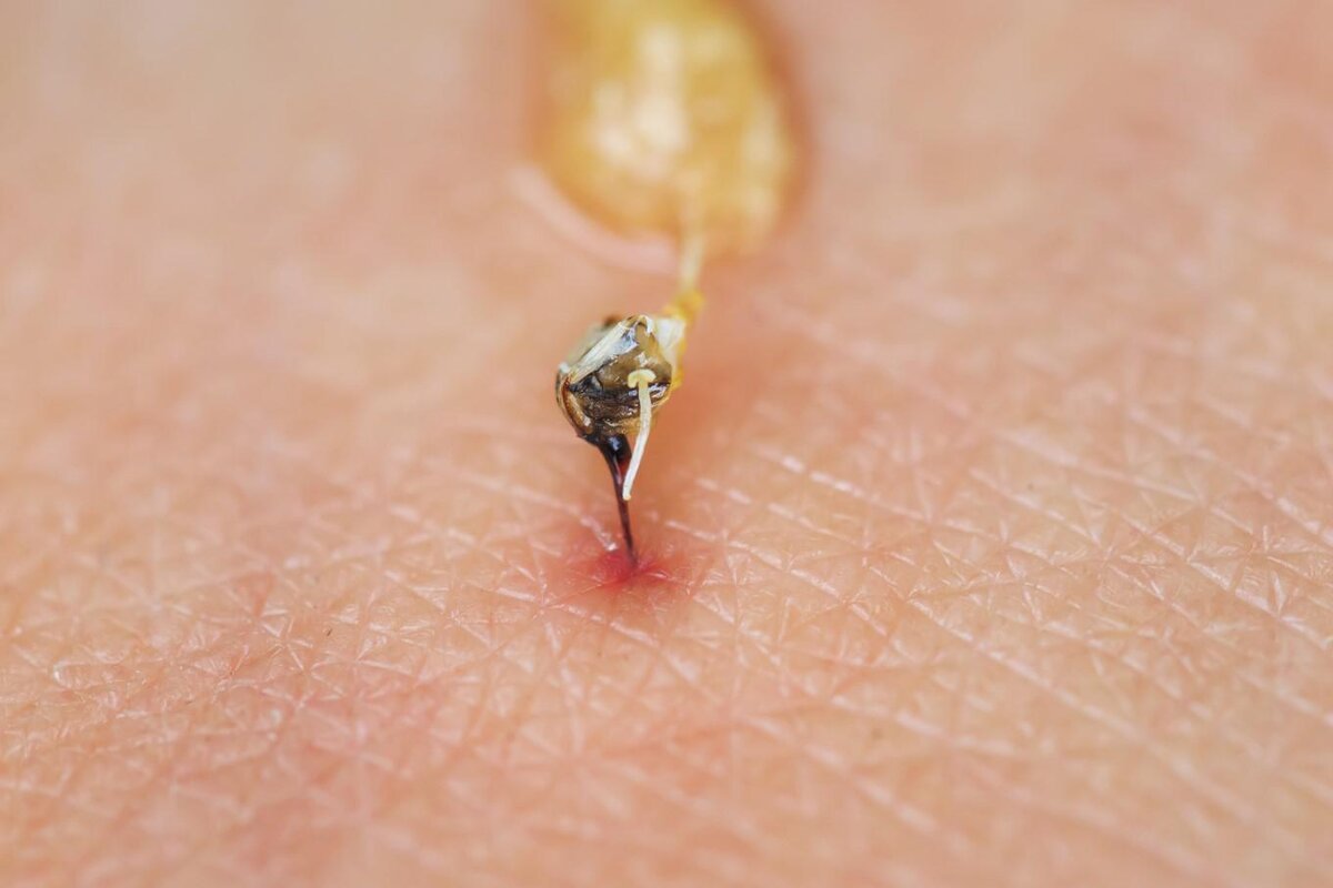 Shutterstock📷Пчеле не обязательно садиться на человека, она может ужалить на лету