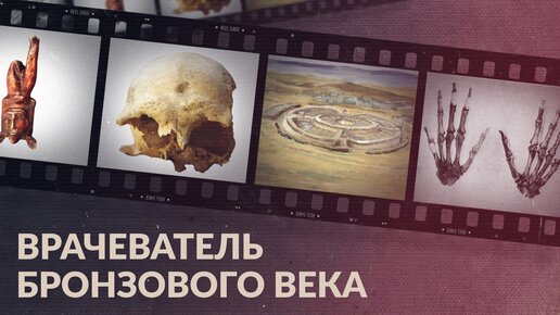 Врачеватель бронзового века / Медицина древнего Аркаима