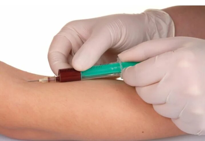 Любое отклонение ХГЧ от нормы требует повторной пересдачи, для исключения ошибки, и дополнительных методов обследования.