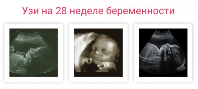 Третий триместр беременности (с 28 до 40 недель)
