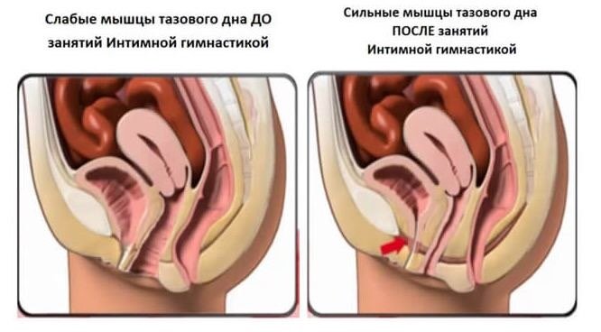 Новости от giz.by: Зачем тренировать интимные мышцы?