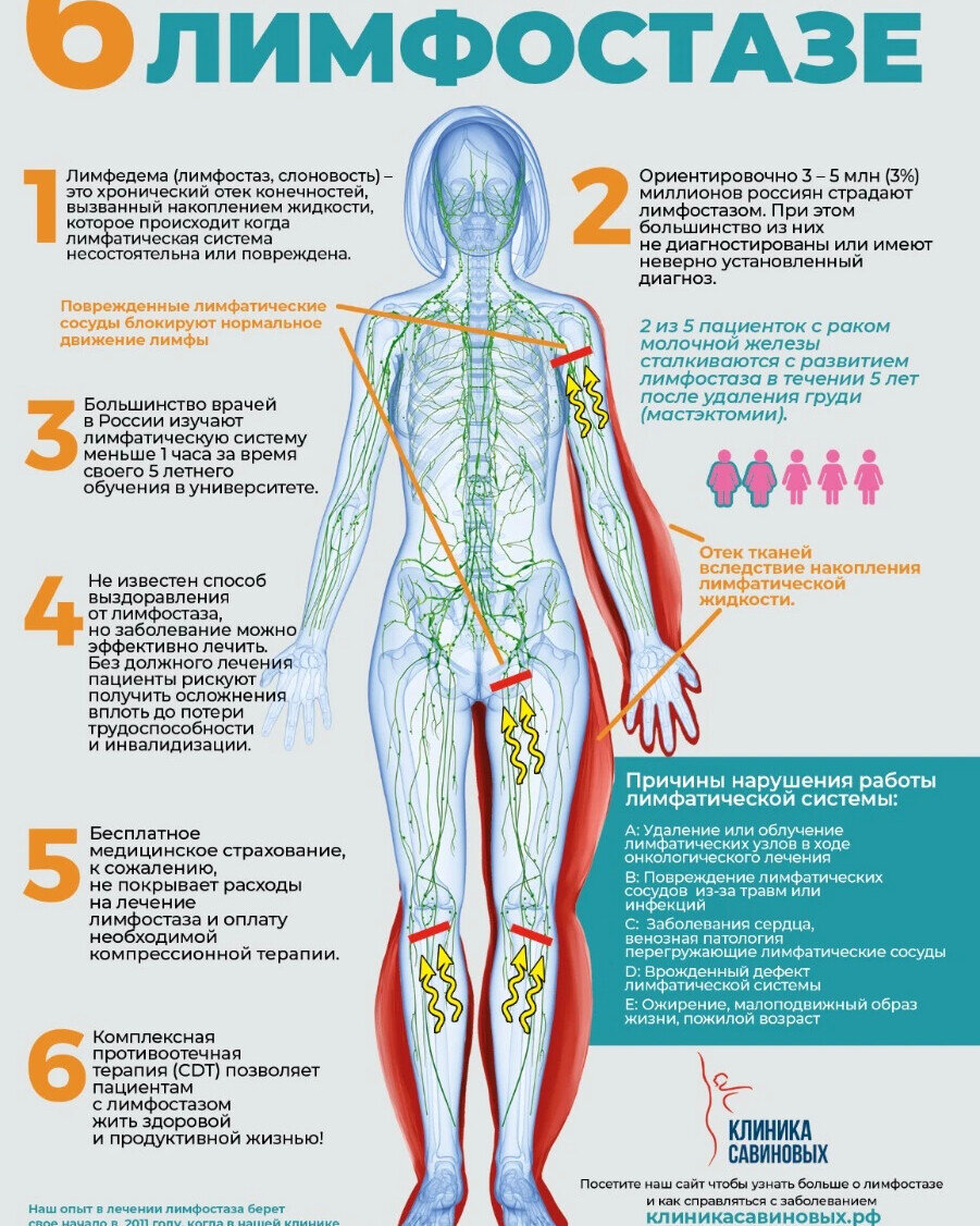 Как восстановить лимфатическую систему при ее нарушении. Лекарства при лимфостазе ног. Лимфостазе нижних конечностей. Лекарство при лимфатических отеках. Препараты для лечения лимфостаза ног.