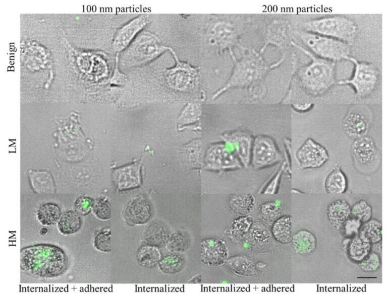   Наночастицы и метастазы / © Пресс-служба МФТИ