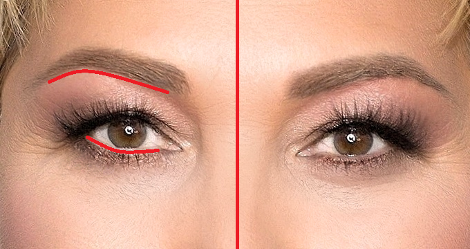 Показала схематично места нанесения