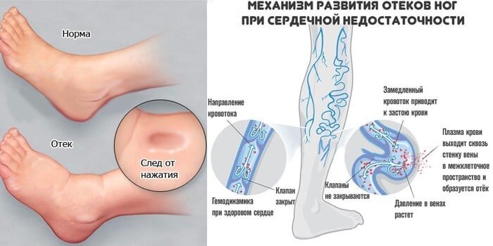 Противопоказания к массажу - медцентр 