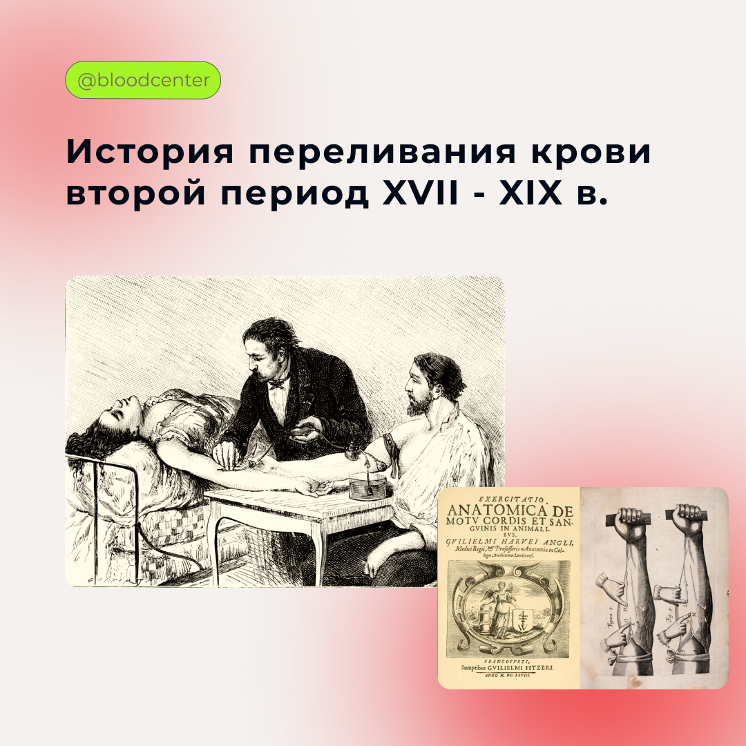 История переливания крови второй период XVII- XIX в. | Центр крови имени  О.К. Гаврилова ДЗМ | Дзен