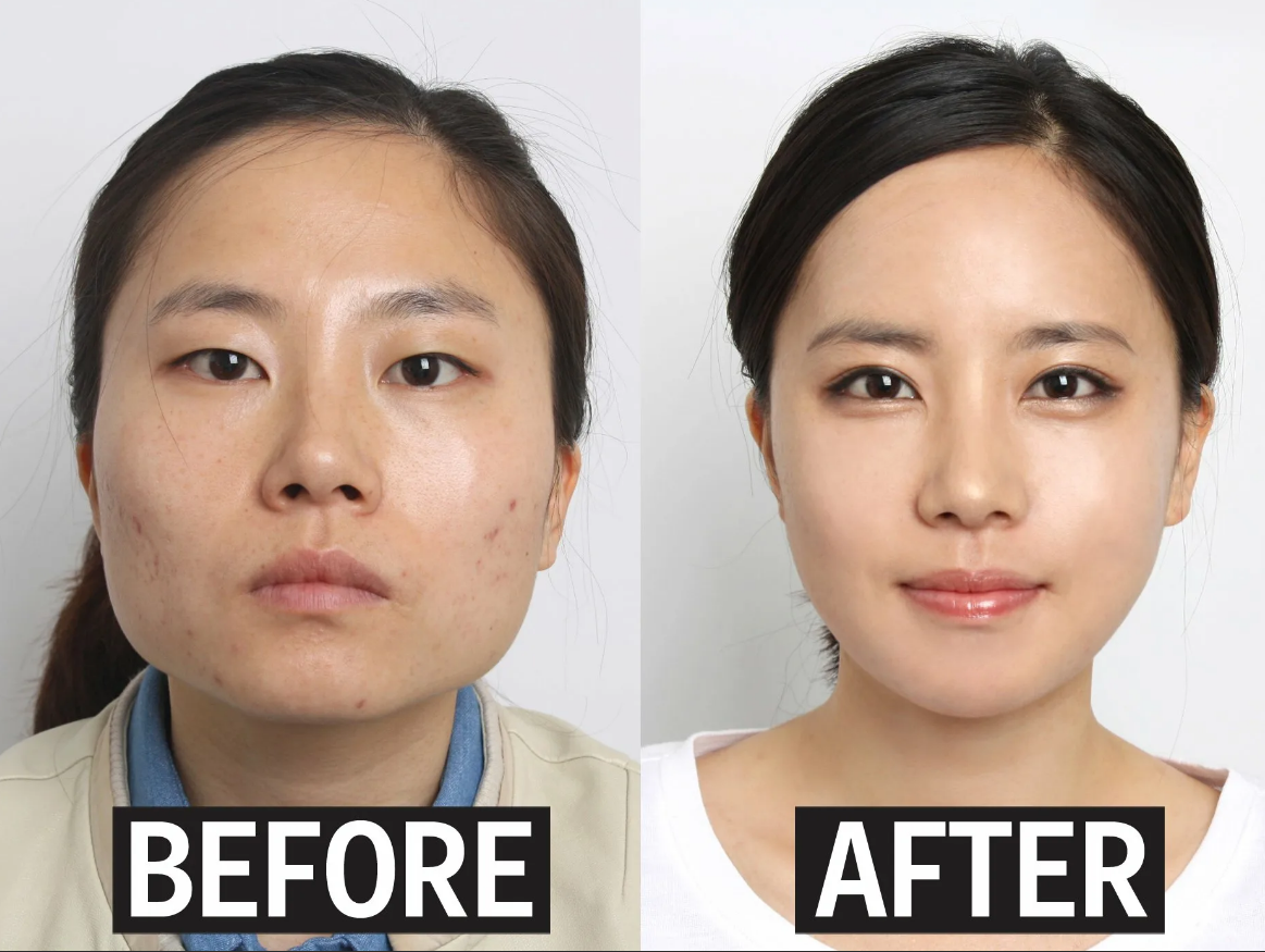 Миллионы фотографий До и После в корейских клиниках