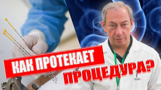 КАК ПРОТЕКАЕТ ПРОЦЕДУРА? #здоровье #онкология #простата #рак простаты ...
