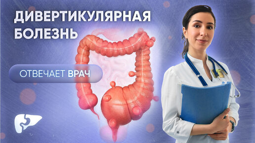 Download Video: Дивертикулярная болезнь: симптомы, причины, обследование