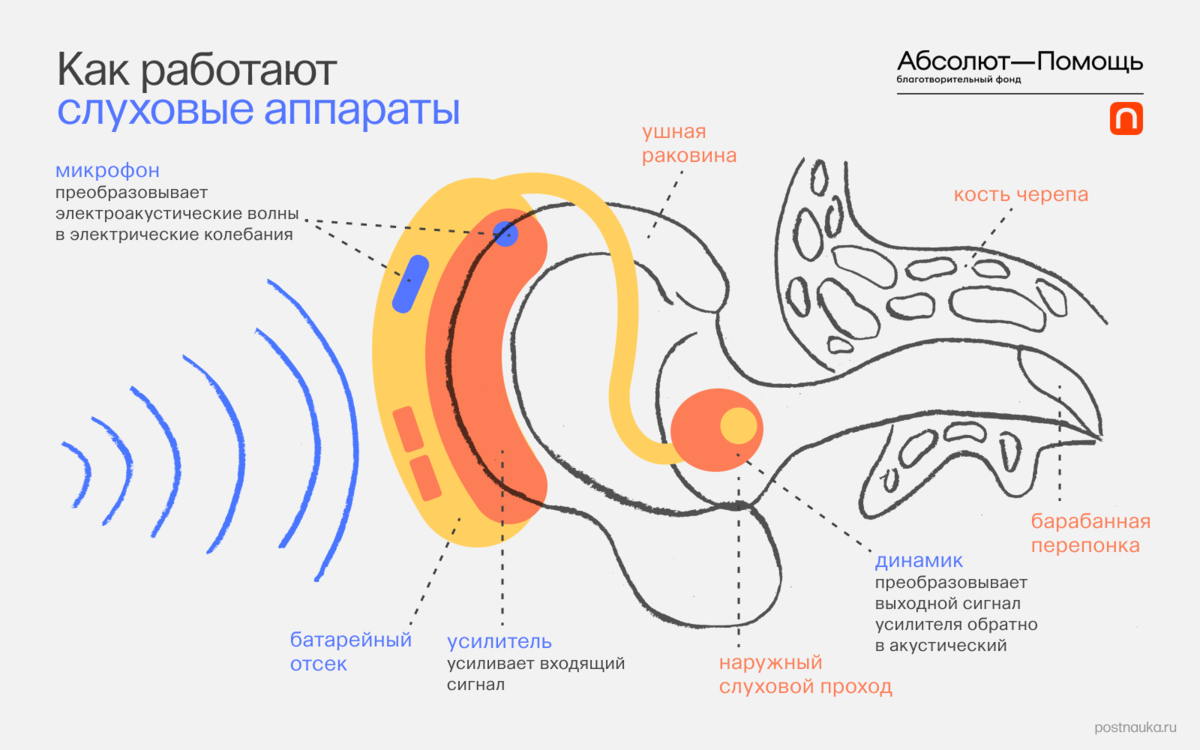 Как выбрать слуховой аппарат Украина | Центр слуха Евротон