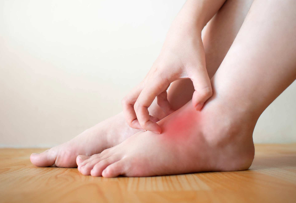 «Диабетическая стопа» - что это? Чем она опасна? | Всего понемногу: о ...