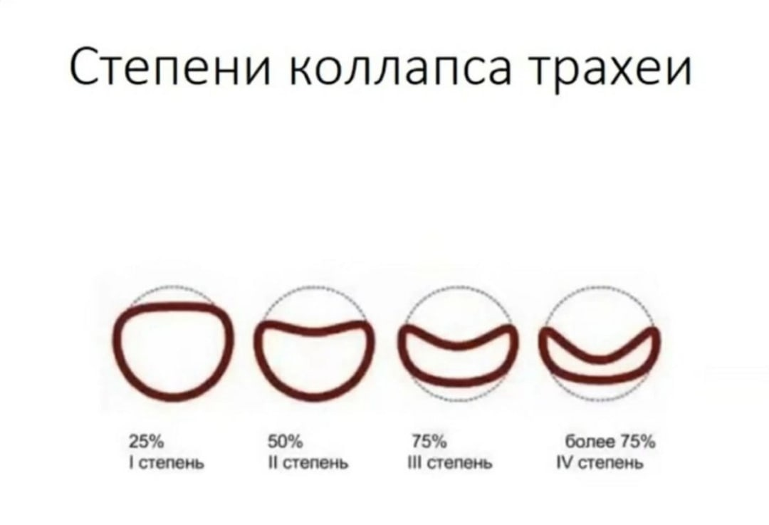 Трахея у собак симптомы и лечение. Степени коллапса трахеи у собак. Стадии коллапса трахеи у собак. Коллапс трахеи у йоркширского терьера. Коллапс трахеи у собак мелких пород.